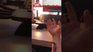 Myoelectric Prosthetic Hand - Arduino