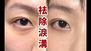 0成本按摩去淚溝眼袋 | 不醫美！告別遮瑕 日本爆火去淚溝按摩法來了