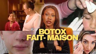 Du botox à ses enfants ? La sous-estimation et le marketing du botox