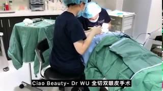 Ciao Beauty-Dr WU全切双眼皮+内眼角手术