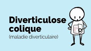 Qu’est-ce que la diverticulite/diverticulose/maladie diverticulaire? | Société gastro-intestinale