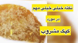 کپک عرق _  نکته خیلی خیلی مهم در مورد کپک روزهای اول عرق انداختن