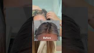 My affordable hair loss solution that actually works!? #hairloss #hair #hairlosstreatment #beauty