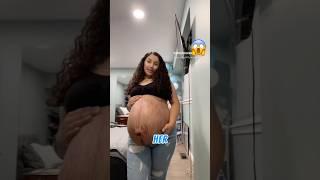The Most Emotional Birth Story You’ll See Today ‼️ #shorts
