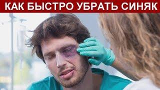 СИНЯК ПОД ГЛАЗОМ, КАК БЫСТРО УБРАТЬ В ДОМАШНИХ УСЛОВИЯХ