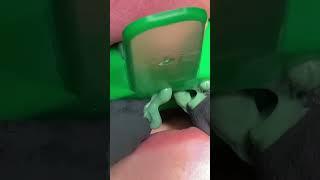 For two veneers!