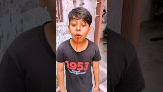 "Sonu Ko Banaya Pagal! Monu Ka Ulti Ka Natak Dekh Ke Sab Hairaan! | Funny Shorts Video #shorts#funny