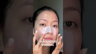 #BLACKHEADS REMOVAL!!! @ilsoporepatch #skincare #skincaretips #blackheadsvideos