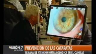 Visión Siete: Prevención de las cataratas