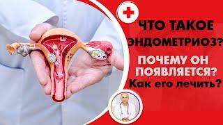 Что такое эндометриоз?  Почему он появляется и как его лечить?