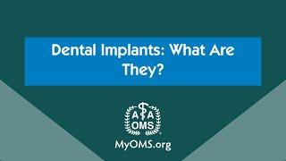 Dental Implants: What Are They?