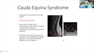 Fundamentals of Orthopaedics Session 11 - Spines