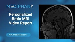 Brain MRI Video Report