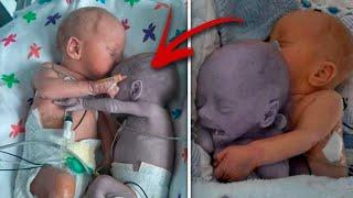 Mom puts the baby on her dying little brother  and five minutes later  a miracle happens...# warm h