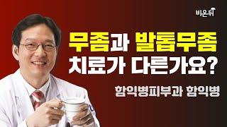 무좀과 발톱무좀 치료는 다른가요? (함익병피부과 함익병)