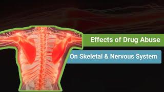 Effects of Drug Abuse on the Skeletal and Nervous Systems