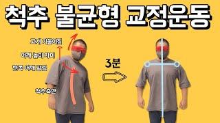 척추측만 + 어깨높이 + 고개기울어짐 + 한쪽라운드숄더  교정운동