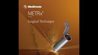 Medtronic: METrx system