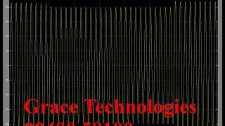 Wide Correction Range Three-Level Dynamic Voltage Corrector - During Sag