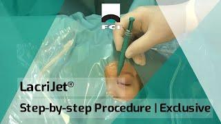 LacriJet® | Preloaded & Self-Retaining Monocanalicular Nasolacrimal Intubation | Surgical Procedure