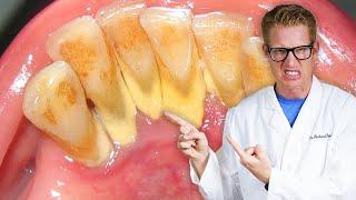 Dentist Explains TOOTH PAIN AFTER DEEP CLEANINGS! Sensitive Teeth, Gums Ache, & Severely Hurt