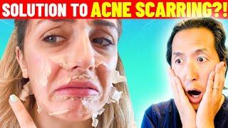 Plastic Surgeon Reacts to Face PEELING OFF From Chemical Peel!