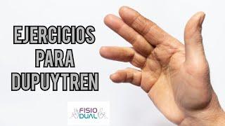 Ejercicios para DUPUYTREN