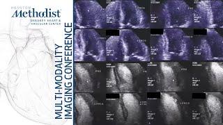 The Role of Stress Echocardiography: Ischemia Evaluation & Beyond (M. Quinones MD) December 14, 2021