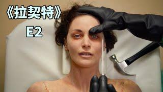 【蛋挞】那些被切除大脑的人，后来怎么样了？《拉契特》第二集