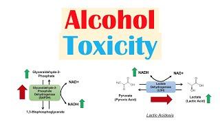 Alcohol Toxicity | Toxic Effects of Ethanol on Liver Metabolism (Metabolic Consequences)