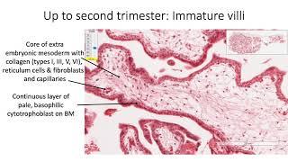 Histology with Chimmalgi: Placenta