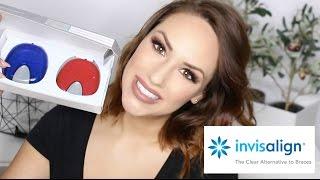 WIE TEUER IST INVISALIGN? | INVISALIGN TEIL 3 || KathisFinest