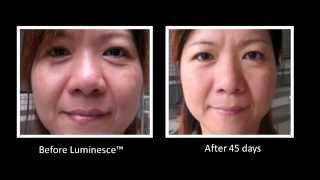 Jeunesse Global LUMINESCE Cellular Rejuvenation Serum Amazing Before & After Photos