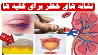 ده نشانه خطرناک که خبر از مشکلات کلیه های شما میدهد_ علائم نارسایی کلیوی