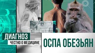 Оспа обезьян: новая пандемия или вирус для хайпа? | Диагноз