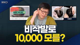 10,000 모를 비삭발 수술로?