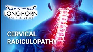 Longhorn Brain and Spine - Cervical Radiculopathy