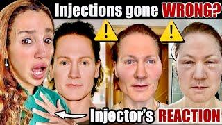 Bryan Johnson's Scary Reaction to Face Injections- Sculptra & Renuva gone WRONG!