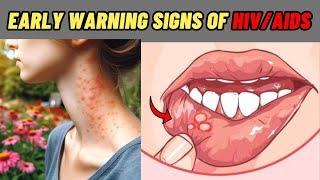 Identify The Early Signs Of HIV AIDS | Signs Of HIV Positive | HIV AIDS Symptoms