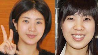 [Korean plastic surgery, ID Hospital Korea] - The best Korean plastic surgery clinic