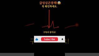당신도 예외일 수 없습니다. 건강을 위한 1분 투자! 지금 시작하세요. #급성심근경색 #가족건강 #보약 #영양제추천 #건강지식 #건강정보 #심장병 #겨울철건강 #질병예방