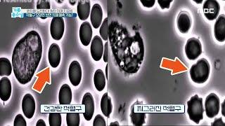 [기분 좋은 날] 적혈구 모양과 크기로 우울증 예측 가능하다? MBC 200918 방송