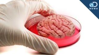 Mini Human "Brain" Grown In Lab