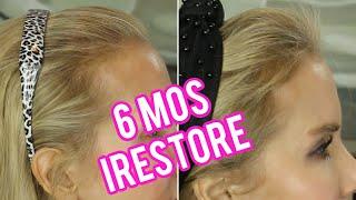 HOW TO IMPROVE THINNING HAIR NATURALLY | SEE MY IRESTORE SIX MONTHS RESULTS | FOLLOW MY HAIR GROWTH