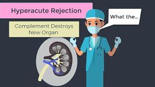 Transplant Immunology Bone marrow versus Solid Organ Transplantation