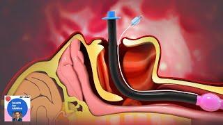 Difficult Airway Management - Airway Assessment | Intubation: Anesthesiologist explains