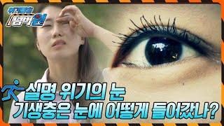 눈에서 기생충이 자란다?! 실명을 일으키는 기생충은 어떻게 눈에 들어가게 됐을까? [위기탈출 넘버원] KBS 120903 방송