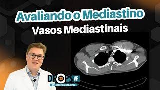 AVALIANDO O MEDIASTINO E VASOS MEDIASTINAIS NA TOMOGRAFIA I VOCÊ RADIOLOGISTA