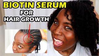 Using Biotin Serum on Scalp for Rapid Hair Growth and Thicken Hair | DiscoveringNatural