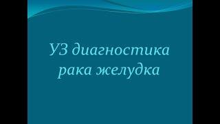 Ультразвуковая диагностика рака желудка